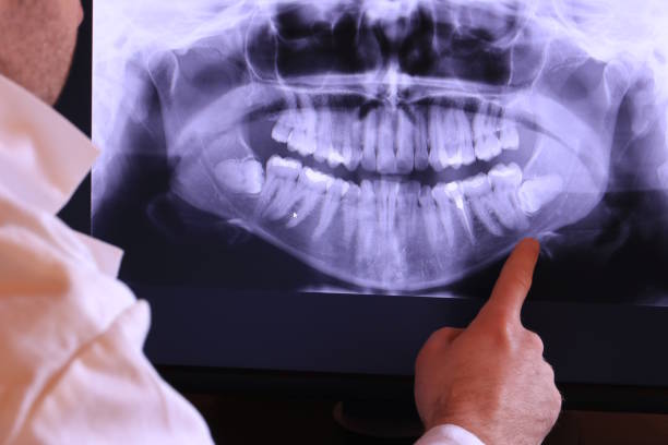 Best Emergency Tooth Extraction in Yorkshire, VA
